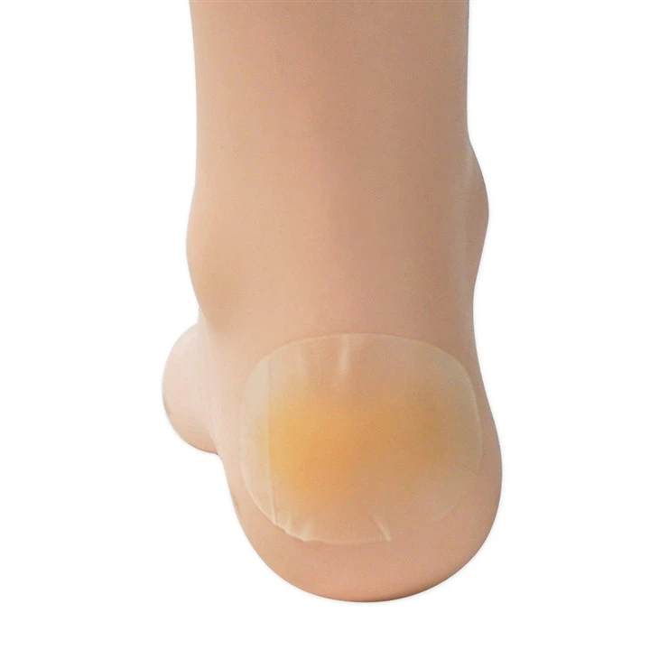 Rhwymynnau gludiog hydrocolloid ar gyfer bysedd traed traed